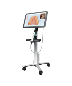 이수역치과 장비 iTero Lumina 구강 스캐너